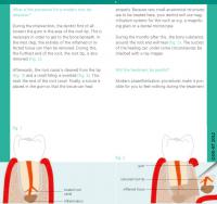 Flyer Endodontic surgery page 3