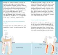 Flyer Wurzelbehandlung Seite 4