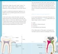 Flyer root canal treatment 2